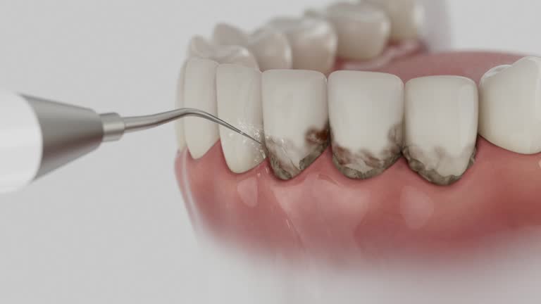 Trusted Dental Crowns And Bridges service in McLendon-Chisholm, TX - Dentist Open Now
